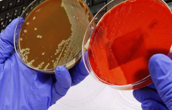 Lectura de cultivos. Laboratori de Refer+¿ncia de Catalunya